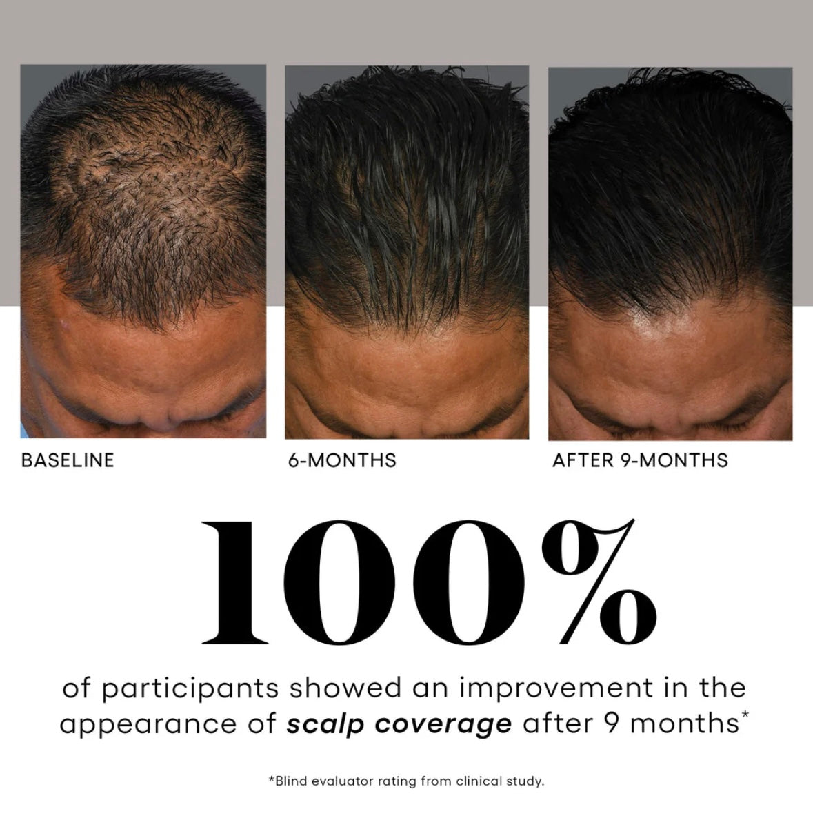 (plated) HAIR Serum