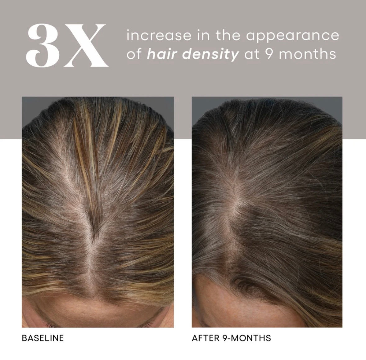 (plated) HAIR Serum