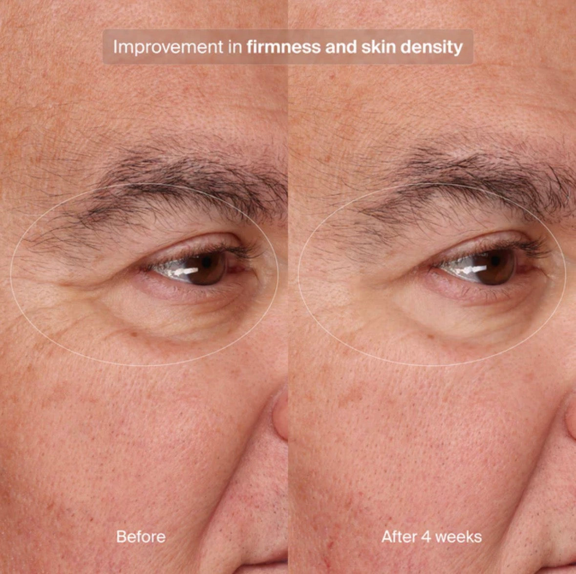 Pavise Advanced Collection