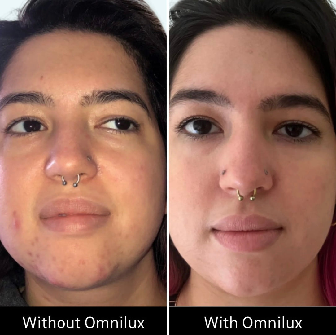 Omnilux Clear