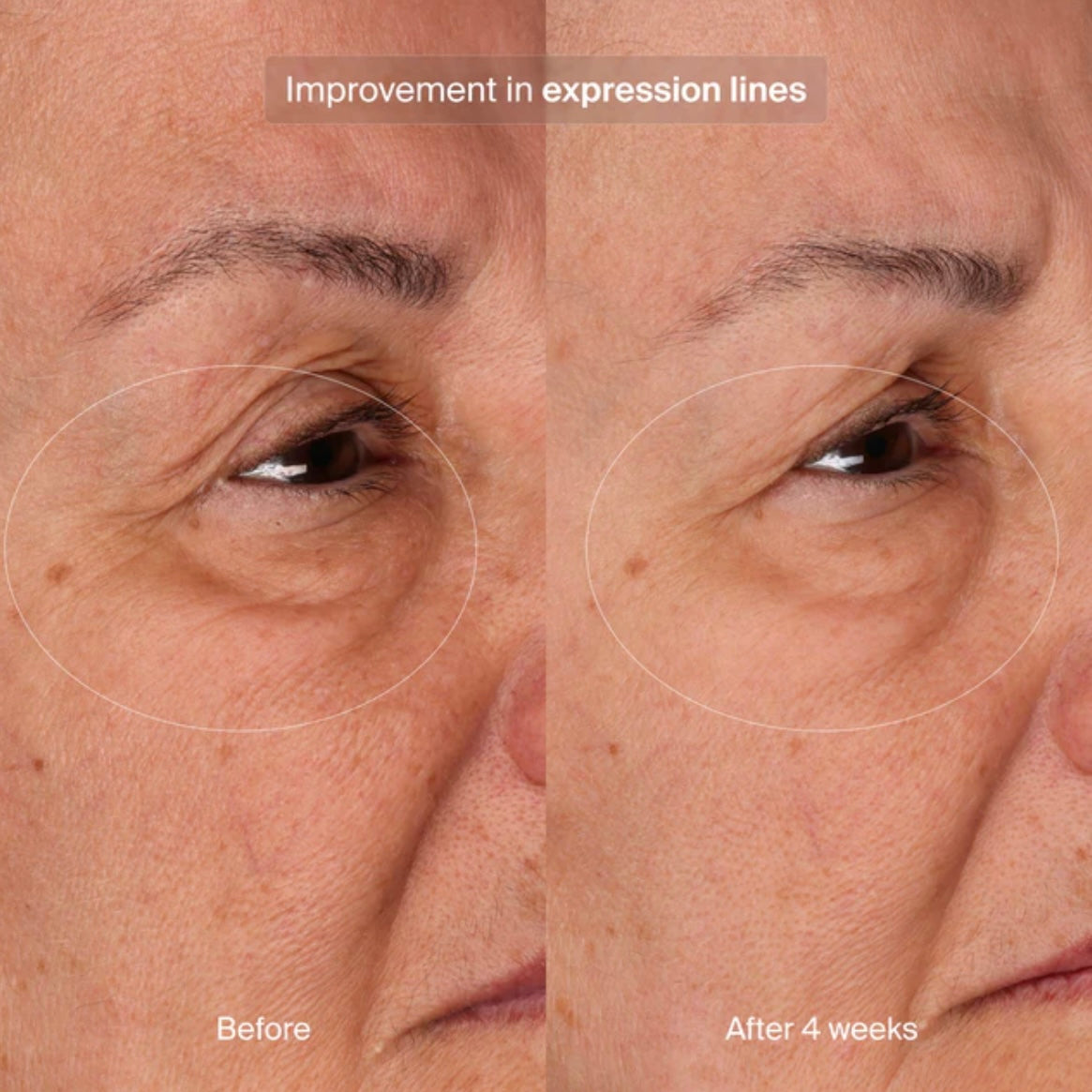 Bioadaptive Stress Repair