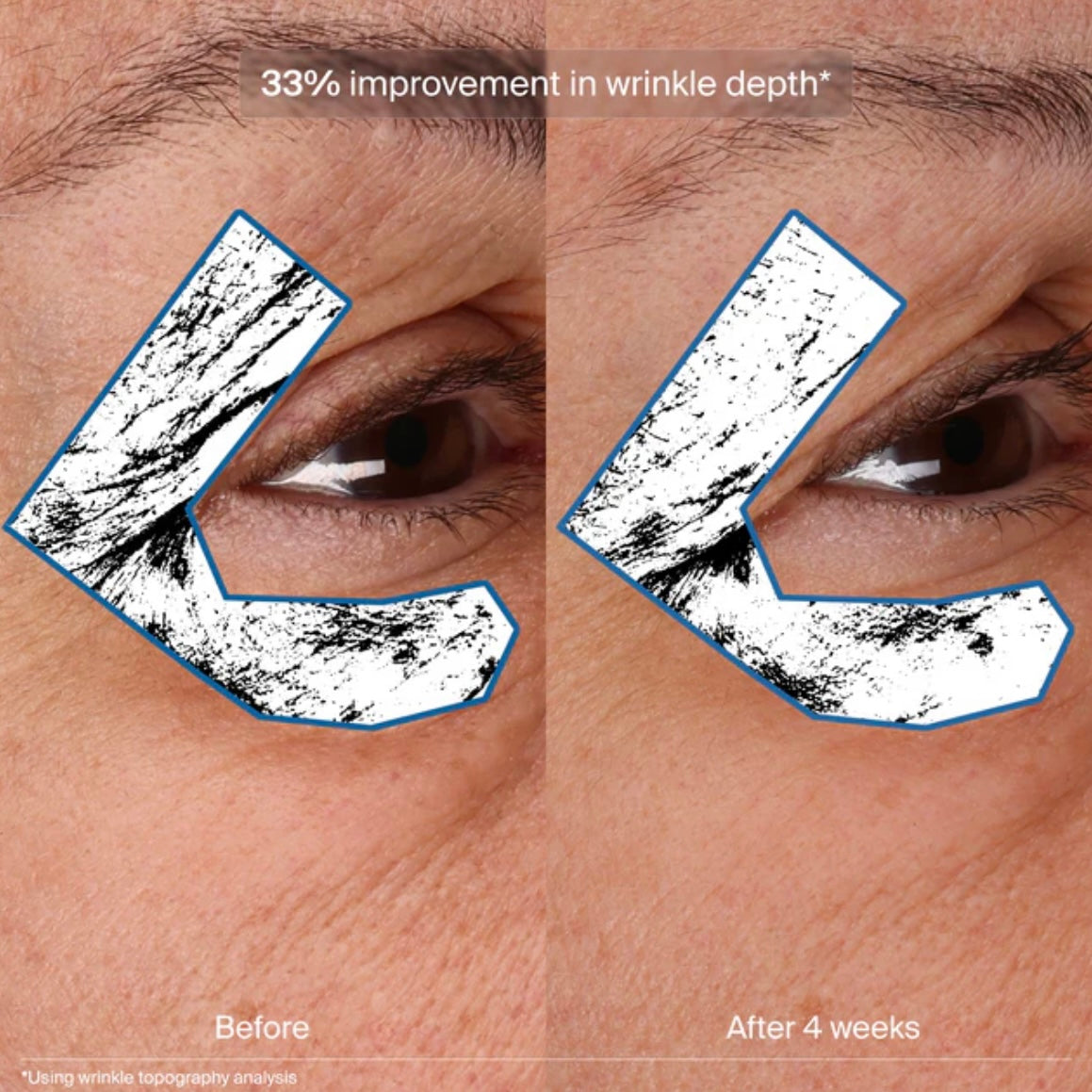 Bioadaptive Stress Repair