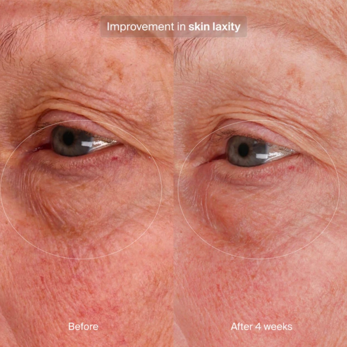 Bioadaptive Stress Repair