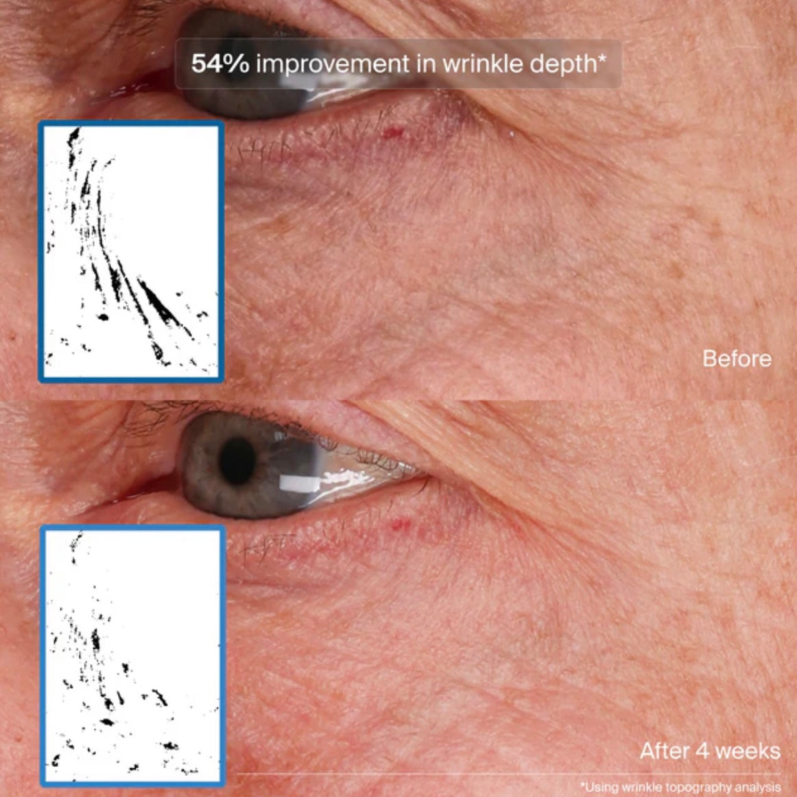 Bioadaptive Stress Repair