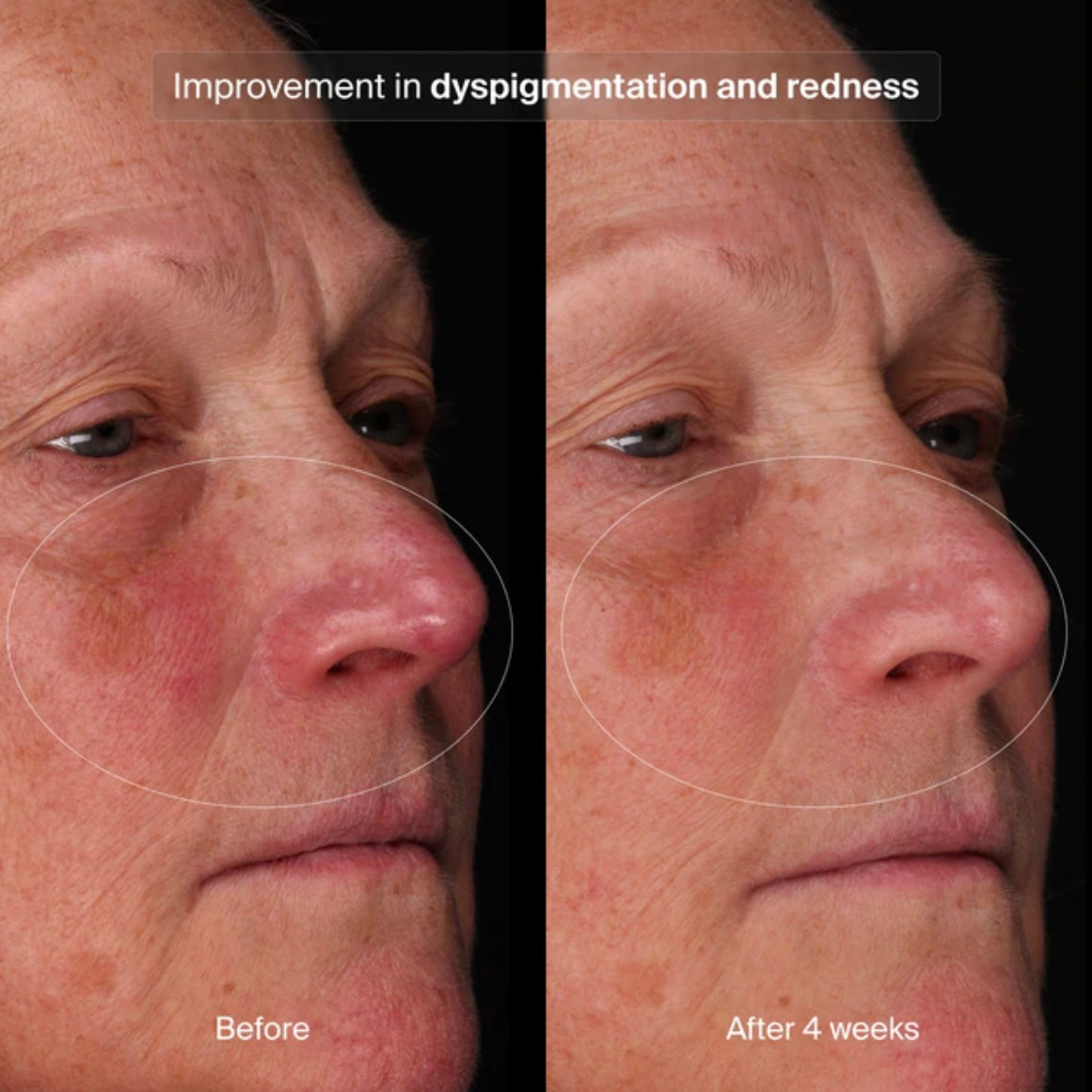 Bioadaptive Stress Repair