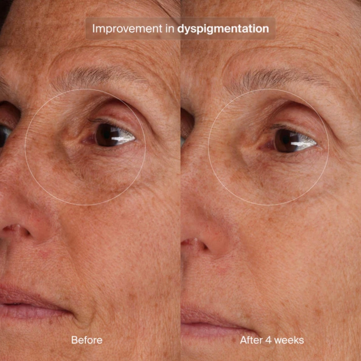 Bioadaptive Stress Repair